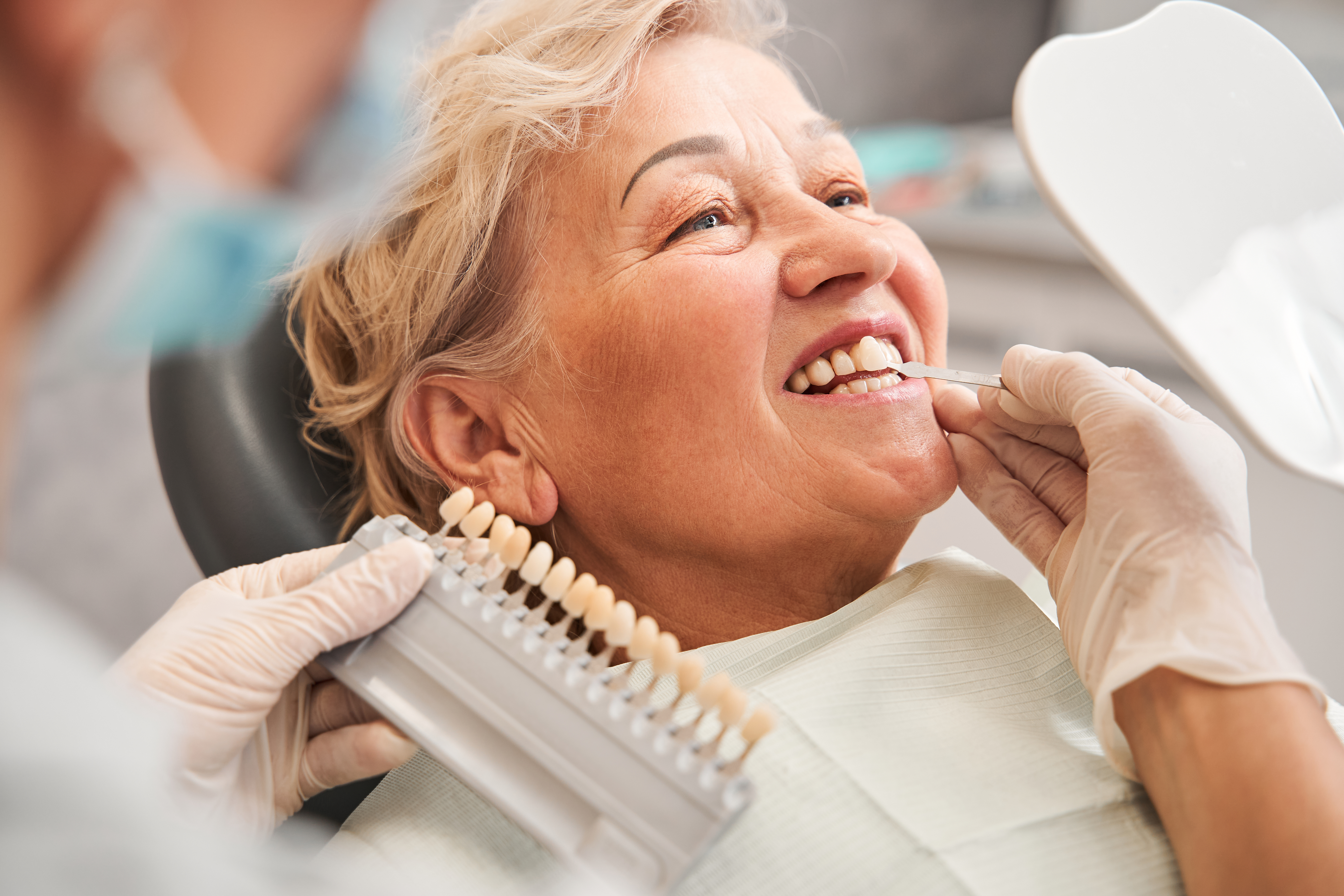 Como verificar se você tem direito a implantes dentários pelo SUS: guia completo